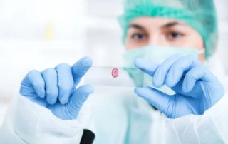 fine-needle-aspiration