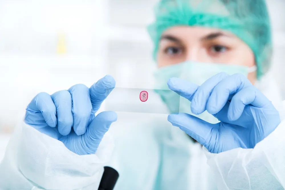 fine-needle-aspiration
