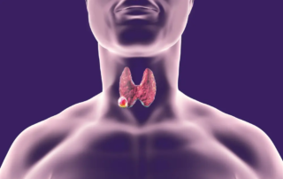 An illustration of a human neck highlighting the thyroid gland, emphasizing the importance of thyroid biopsy for accurate diagnosis and compassionate care in medical treatment.| Dr. Nadelman Biopsy Doctor