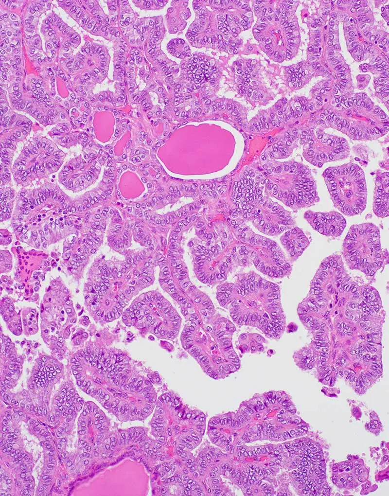 Cancer Biopsy & FNA Doctor in Los Angeles - Dr. Nadelman