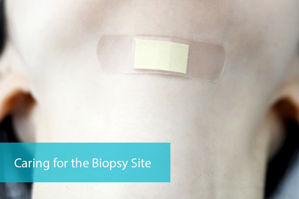 Post-Biopsy-Care-Comprehensive-Tips-and-Advice-for-a-Smooth-Recovery