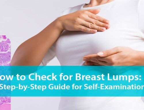How to Check for Breast Lumps: A Step-by-Step Guide for Self-Examination