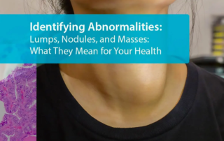 Identifying Abnormalities: Lumps, Nodules, and Masses: What They Mean for Your Health