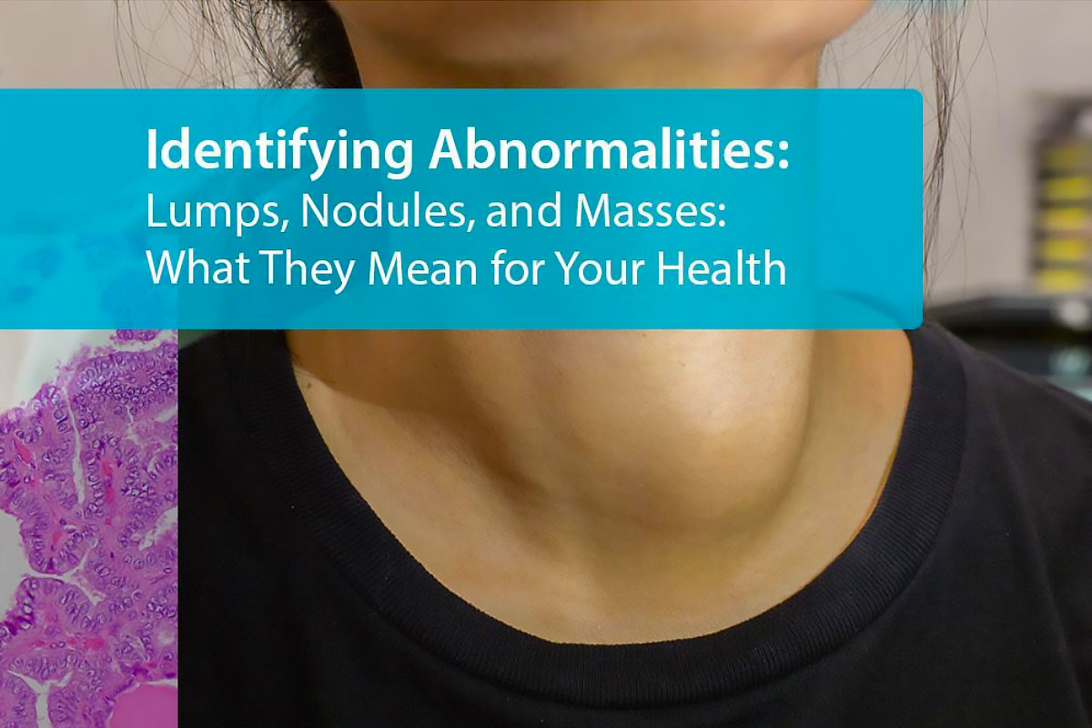 Identifying Abnormalities: Lumps, Nodules, and Masses: What They Mean for Your Health