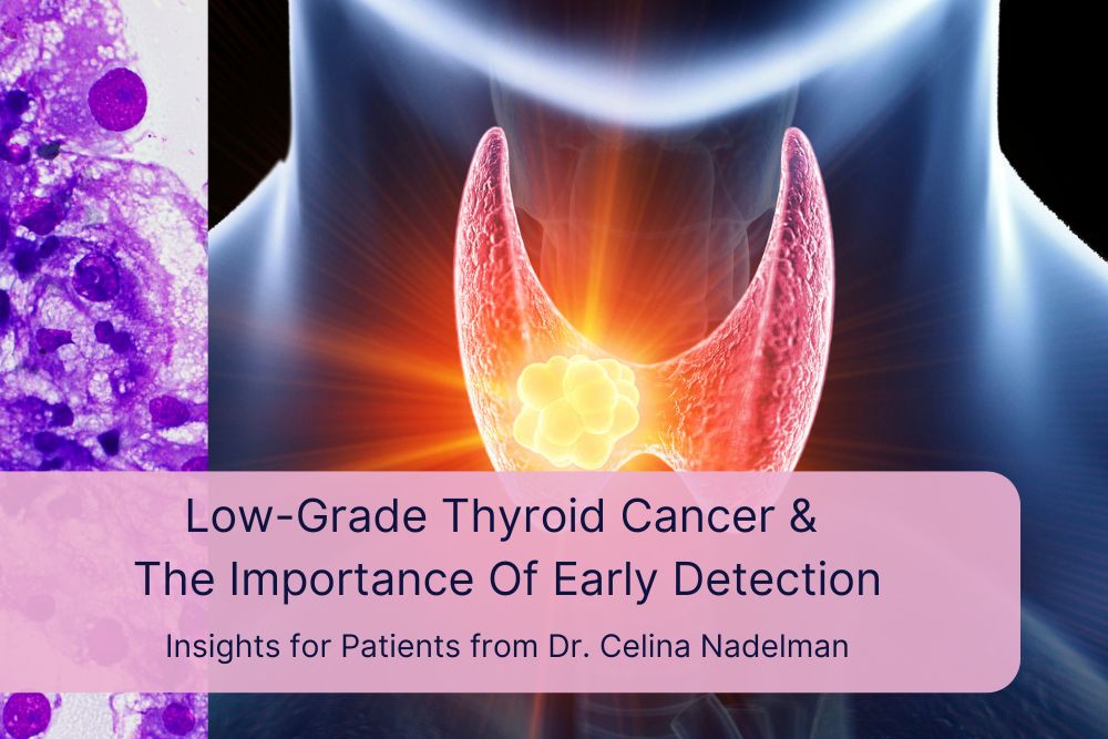 +Low-Grade Thyroid Cancer & The Importance Of Early Detection