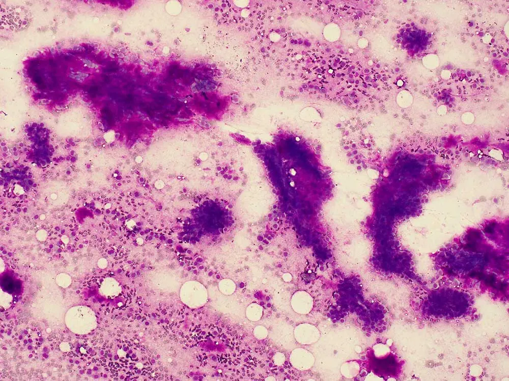 My Journey as an Expert Witness in Cancer Misdiagnosis Cases