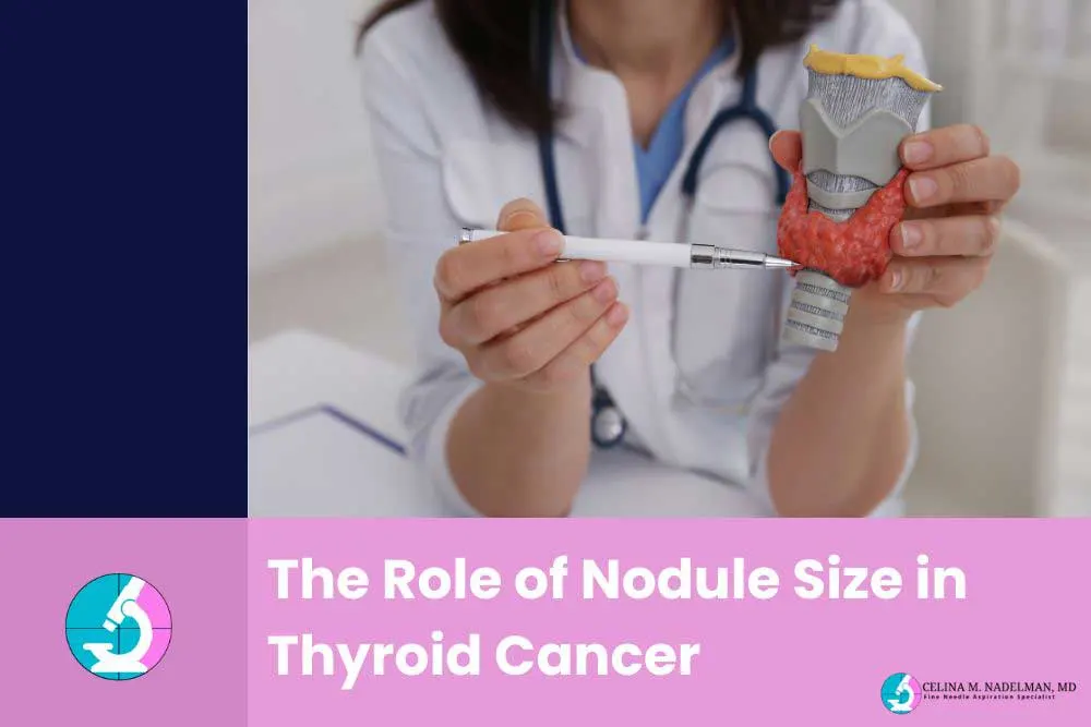 The role of nodule size in thyroid cancer