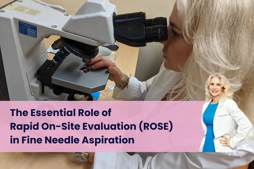 A cytopathologist examines samples through a microscope, highlighting the precision and efficiency of ROSE in FNA biopsy for accurate diagnosis and compassionate care.| Dr. Nadelman Biopsy Doctor