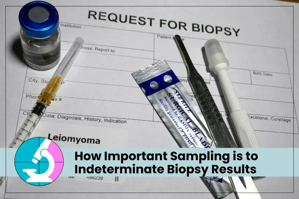 indeterminate biopsy results