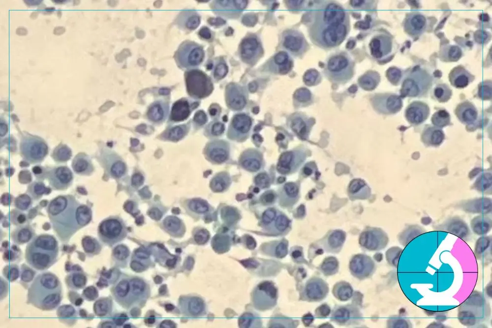 how long does it take to get FNA biopsy results