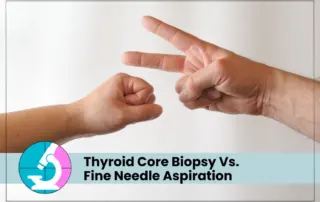 thyroid core biopsy vs fine needle aspiration