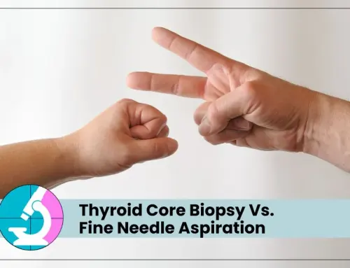 Thyroid Core Biopsy Vs. Fine Needle Aspiration