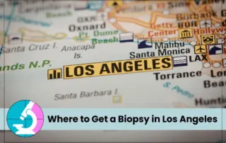 where to get a biopsy in los angeles