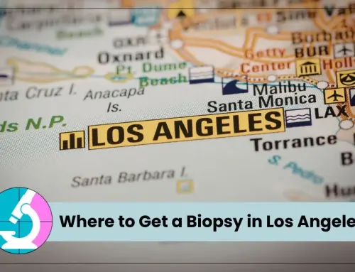 Where to Get a Biopsy in Los Angeles