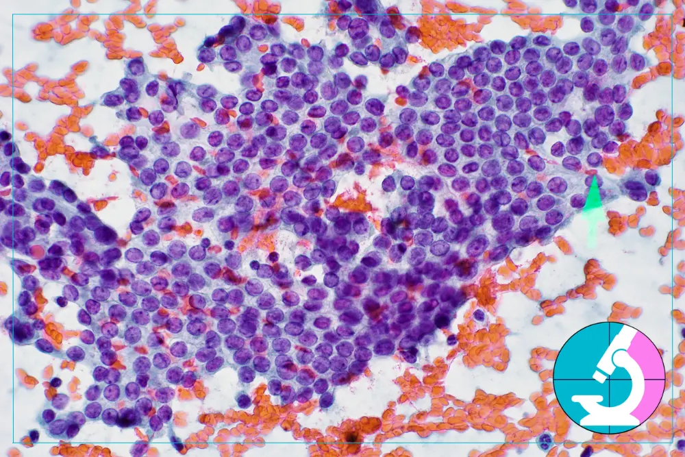 What Actually Makes Cancer, Cancer?
