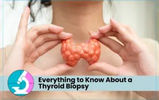 Everything to Know About a Thyroid Biopsy