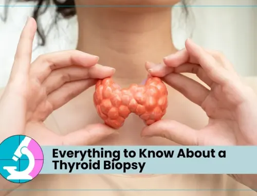 Everything to Know About a Thyroid Biopsy