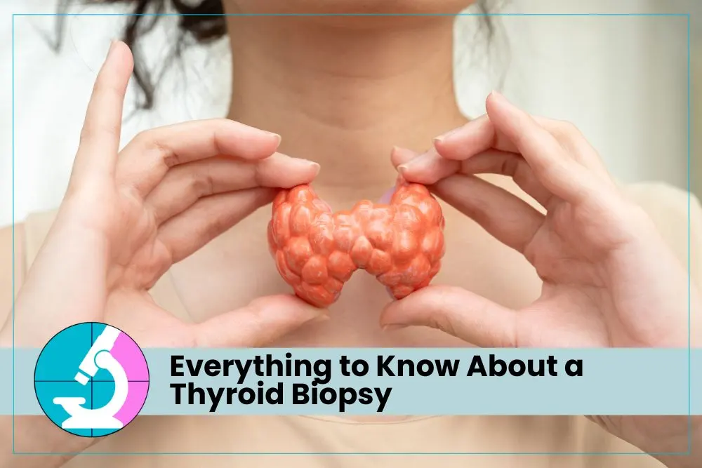 Everything to Know About a Thyroid Biopsy