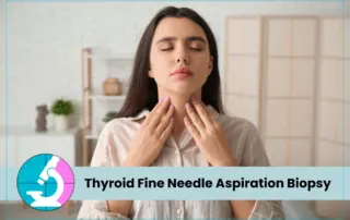 Thyroid Fine Needle Aspiration Biopsy