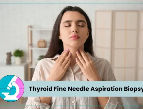 Thyroid Fine Needle Aspiration Biopsy