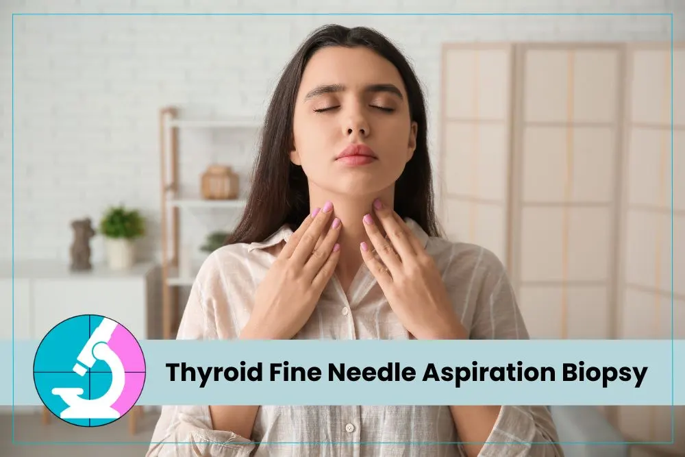 Thyroid Fine Needle Aspiration Biopsy Thyroid Fine Needle Aspiration Biopsy