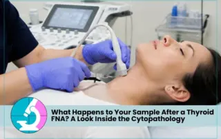 What Happens to Your Sample After a Thyroid FNA