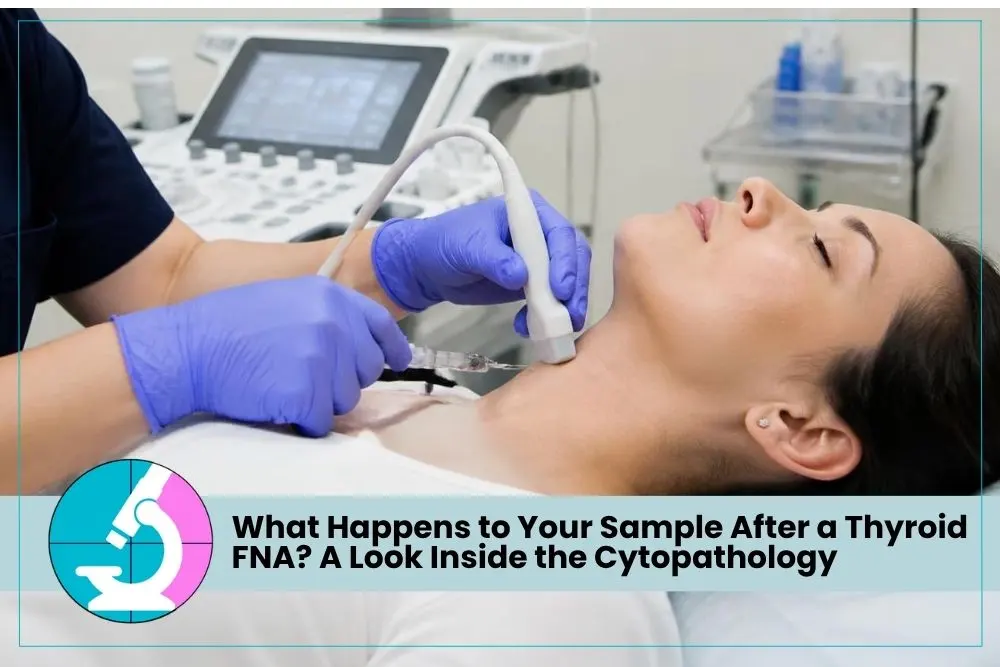 What Happens to Your Sample After a Thyroid FNA