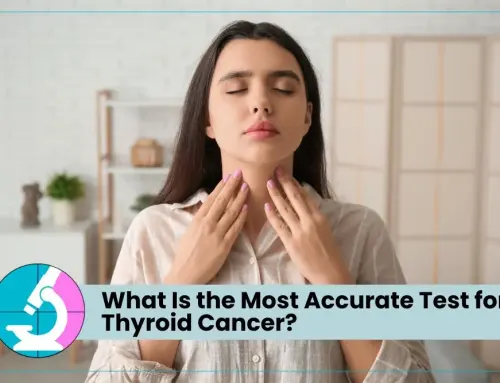 What Is the Most Accurate Test for Thyroid Cancer?