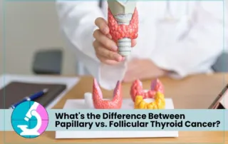 Papillary vs. Follicular Thyroid Cancer