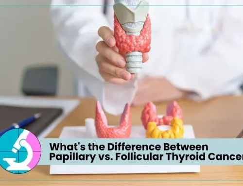 What’s the Difference Between Papillary vs. Follicular Thyroid Cancer?