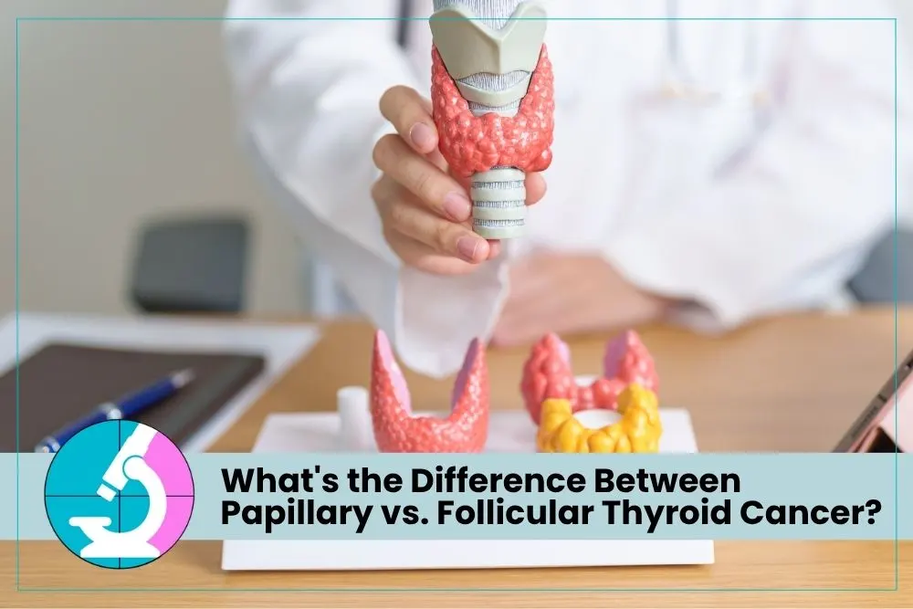 Papillary vs. Follicular Thyroid Cancer
