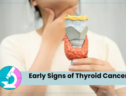 Early Signs of Thyroid Cancer When to Get a Biopsy